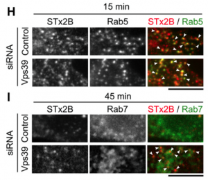 Figure with STx2B transport in cells transfected with control or Vps39 siRNA
