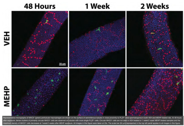 Image of macrophages from Richburg research lab