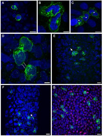 Super-resolution photomicrographs of CD2+ cells (green, applies to all the images in the panel) from whole-mount seminiferous tubule preparations from the corn oil-treated peripubertal rats, imaged at 60×—A) CD2+ single cells uniquely observed with a higher nuclear-to-cytoplasmic ratio (relatively large nuclei with a thin rim of cytoplasm) and serrated border. (B) CD2+ clone of two cells. (C) Clone of three cells. Confocal photomicrographs of the whole-mount seminiferous tubule preparations