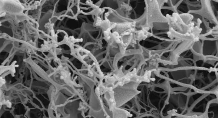 A microscopic image of remdesivir powder formulations after the thin-film freezing process. All formulations exhibited a brittle matrix structure of highly porous particles.